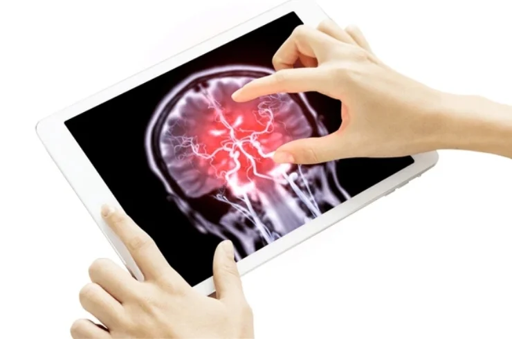 Neuro Imaging